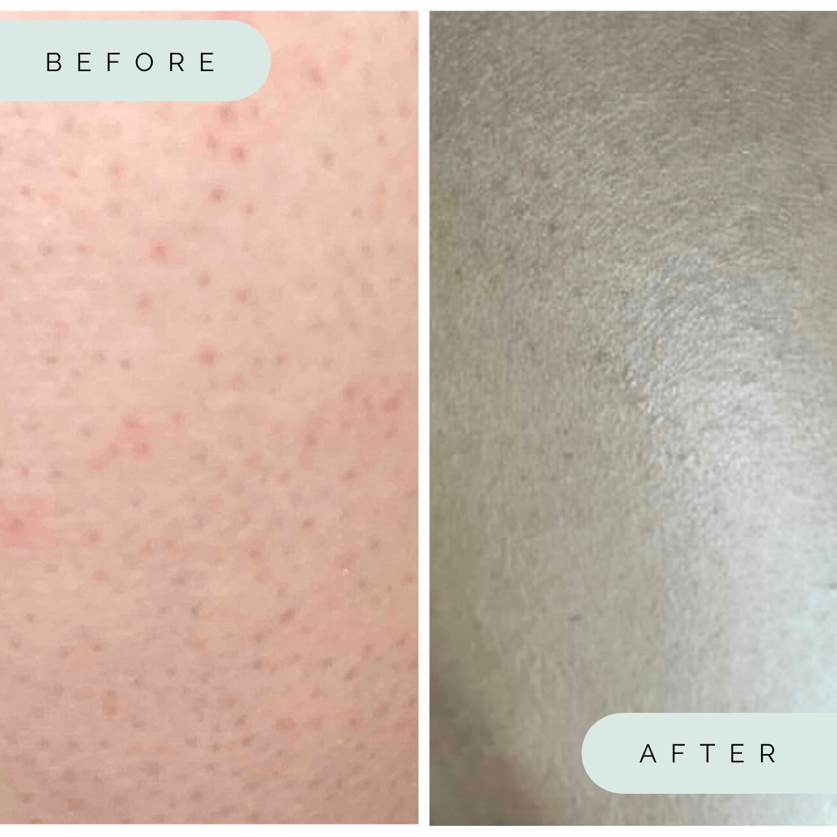Wildpier™️ Luxe Deep Exfoliating Glove